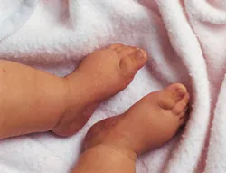 Close-up of two tiny infant feet resting on a soft, white blanket.
